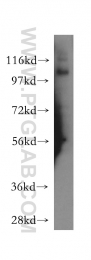 10244-1-AP - USP11