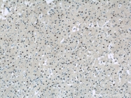 22340-1-AP - USP11