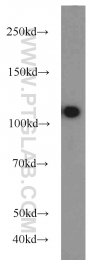 22340-1-AP - USP11