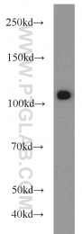 22340-1-AP - USP11
