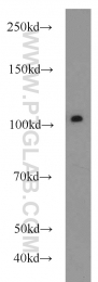 22340-1-AP - USP11