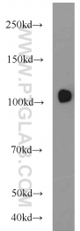 22340-1-AP - USP11