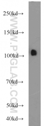 22340-1-AP - USP11