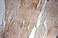 16840-1-AP - USP13