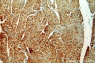 16840-1-AP - USP13