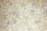 16840-1-AP - USP13