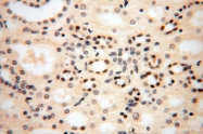16840-1-AP - USP13