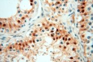 16840-1-AP - USP13