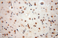 16840-1-AP - USP13