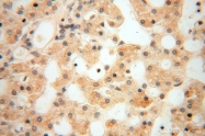 16840-1-AP - USP13