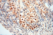 16840-1-AP - USP13