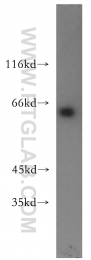 14517-1-AP - USP14