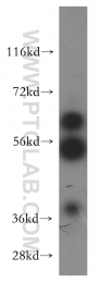 14517-1-AP - USP14