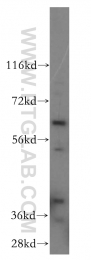14517-1-AP - USP14
