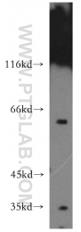 14517-1-AP - USP14