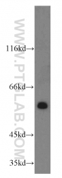 14517-1-AP - USP14