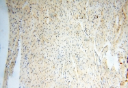 14055-1-AP - USP16
