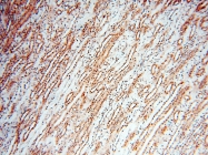 14055-1-AP - USP16