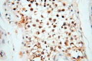 14055-1-AP - USP16