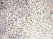 14055-1-AP - USP16