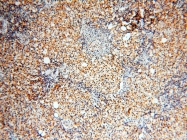 14055-1-AP - USP16