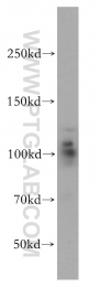 14055-1-AP - USP16