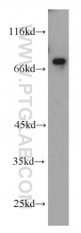 10392-1-AP - USP2