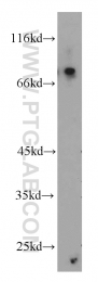 10392-1-AP - USP2