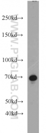 10392-1-AP - USP2