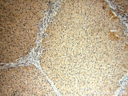 15404-1-AP - USP2