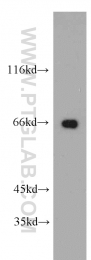 55110-1-AP - USP22