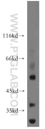 12490-1-AP - USP3