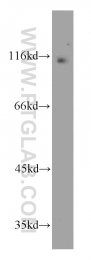 20445-1-AP - USP33 / VDU1