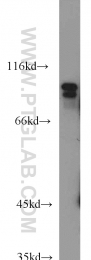 10473-1-AP - USP5 / ISOT