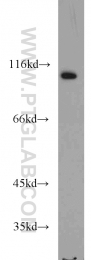 10473-1-AP - USP5 / ISOT