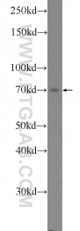 22126-1-AP - Ubiquilin-1 (UBQLN1)