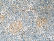 23516-1-AP - Ubiquilin-1 (UBQLN1)