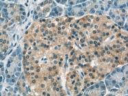 23516-1-AP - Ubiquilin-1 (UBQLN1)