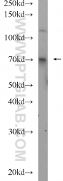 23516-1-AP - Ubiquilin-1 (UBQLN1)