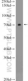23516-1-AP - Ubiquilin-1 (UBQLN1)