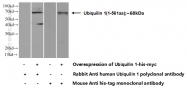 23516-1-AP - Ubiquilin-1 (UBQLN1)