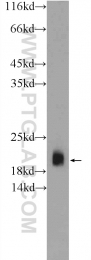 10135-1-AP - VAMP-2 / Synaptobrevin-2