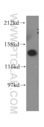 15931-1-AP - VARS (Valyl-tRNA synthetase)