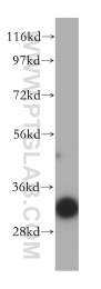 14451-1-AP - VDAC-3