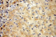 16922-1-AP - Vitamin D-binding protein