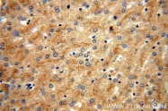 16922-1-AP - Vitamin D-binding protein