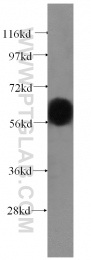 16922-1-AP - Vitamin D-binding protein