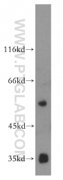 16922-1-AP - Vitamin D-binding protein