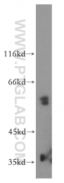16922-1-AP - Vitamin D-binding protein