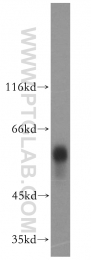 16922-1-AP - Vitamin D-binding protein